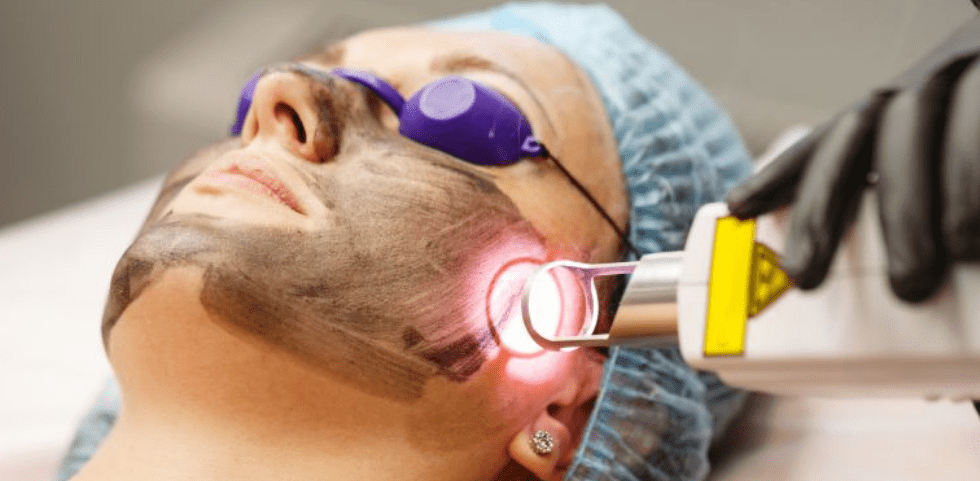 Laser and Skin Treatments